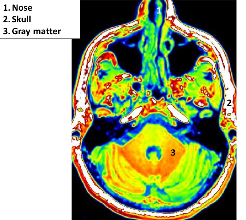 Educational Brain Blochs