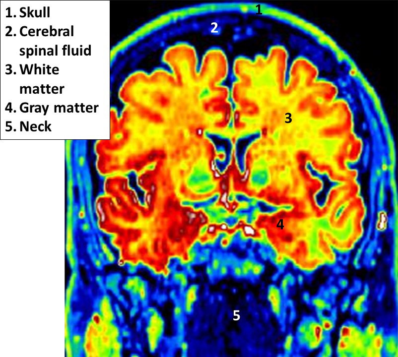 Educational Brain Blochs