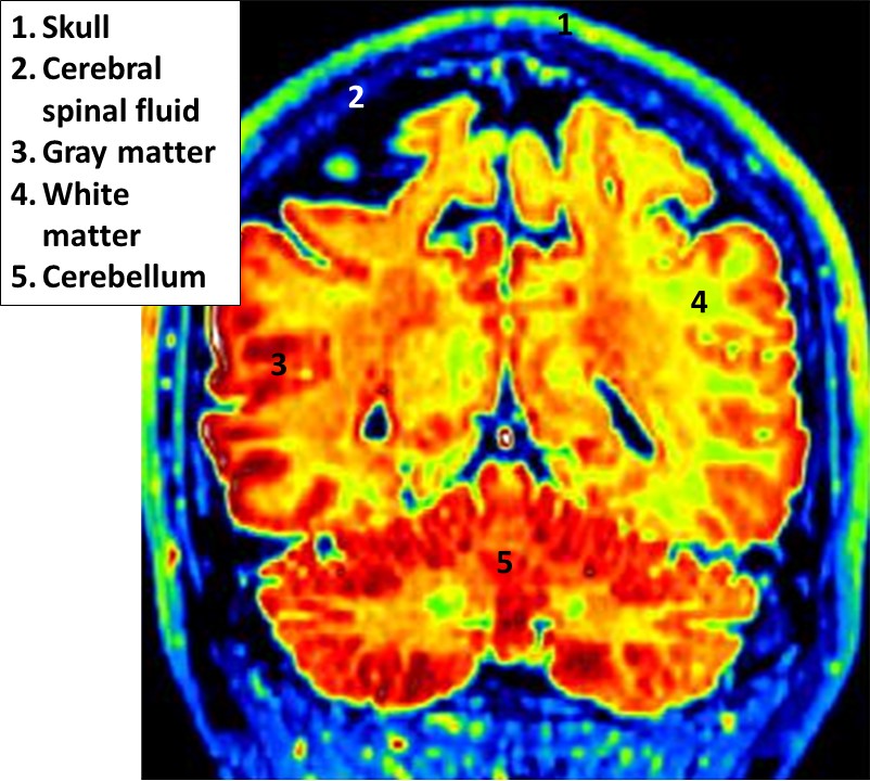 Educational Brain Blochs