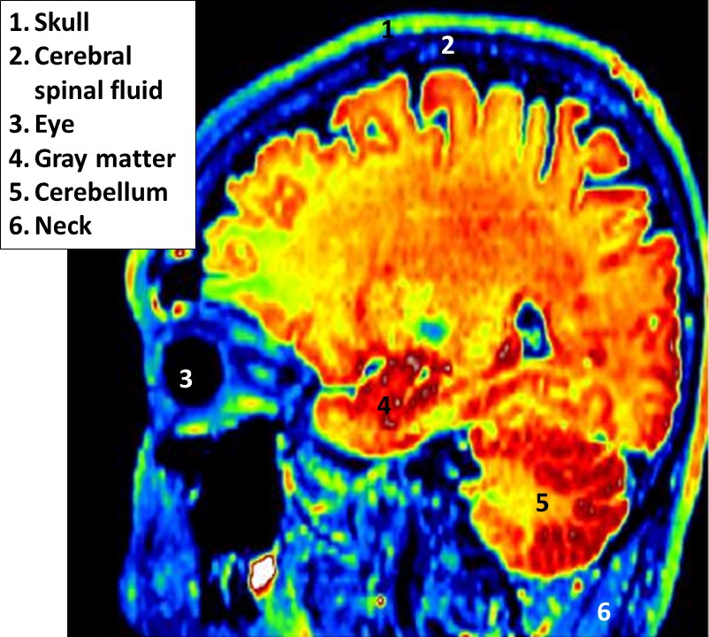 Educational Brain Blochs
